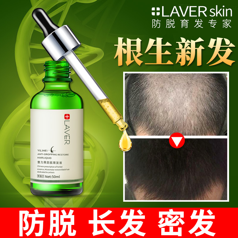 LAVER防脱育发液快速增发浓密发防掉生新发脂溢性头发增长液男女